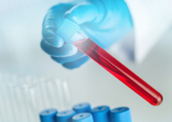 Les promesses de la «biopsie liquide»