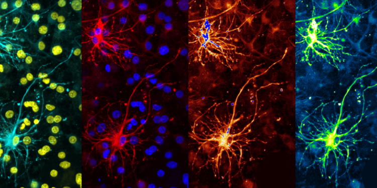 Comment le cerveau décide? Un projet international lancé à Genève veut décoder le fonctionnement des neurones