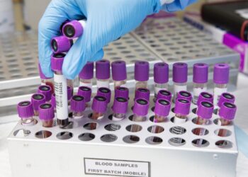 Des tests sérologiques déployés sous peu pour voir l’étendue réelle du Covid-19 en Suisse