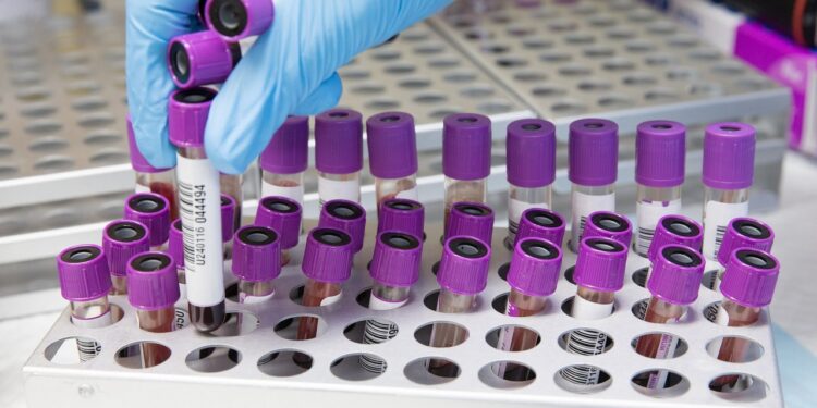 Des tests sérologiques déployés sous peu pour voir l’étendue réelle du Covid-19 en Suisse