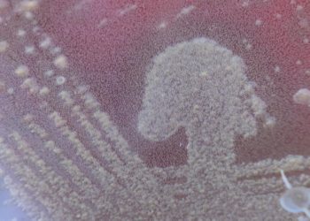 Le sepsis, affection sous-estimée qui fait 4000 morts par année en Suisse