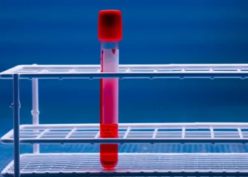 Tests sanguins pour dépister le cancer jusqu’à trois ans avant son apparition: une promesse lestée d’incertitudes