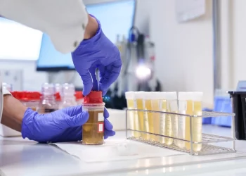 Visite du laboratoire anti-dopage du CHUV, où se joue la « propreté » du sport