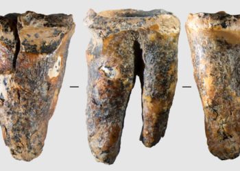 Il y a 60’000 ans, l’homme de Néandertal soignait déjà les caries à coup de silex